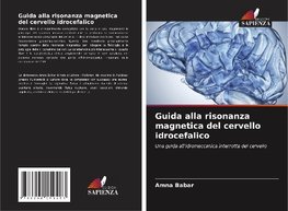 Guida alla risonanza magnetica del cervello idrocefalico