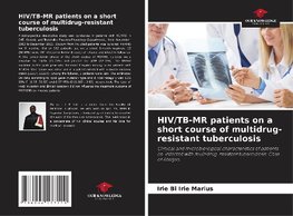 HIV/TB-MR patients on a short course of multidrug-resistant tuberculosis