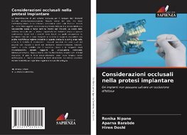 Considerazioni occlusali nella protesi implantare