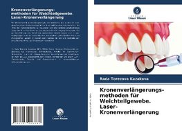 Kronenverlängerungs- methoden für Weichteilgewebe. Laser-Kronenverlängerung