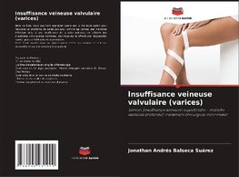 Insuffisance veineuse valvulaire (varices)