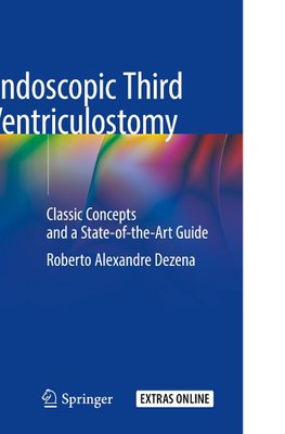 Endoscopic Third Ventriculostomy