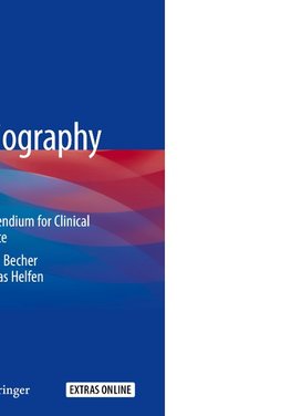 Contrast Echocardiography