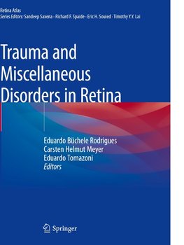 Trauma and Miscellaneous Disorders in Retina