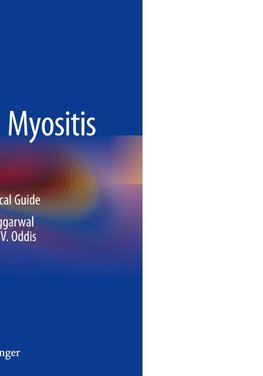 Managing Myositis