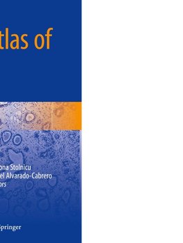 Practical Atlas of Breast Pathology