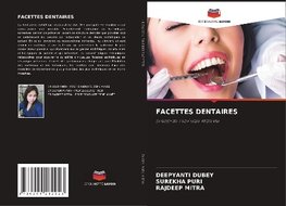 FACETTES DENTAIRES