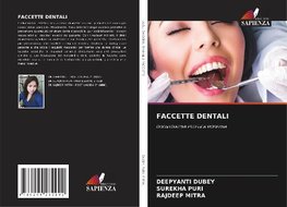 FACCETTE DENTALI