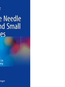 Handbook of Practical Fine Needle Aspiration and Small Tissue Biopsies