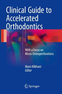 Clinical Guide to Accelerated Orthodontics