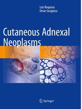 Cutaneous Adnexal Neoplasms