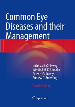 Common Eye Diseases and their Management