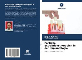 Partielle Extraktionstherapien in der Implantologie