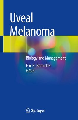 Uveal Melanoma