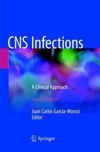 CNS Infections