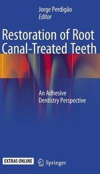 Restoration of Root Canal-Treated Teeth