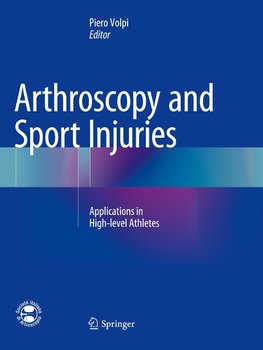 Arthroscopy and Sport Injuries