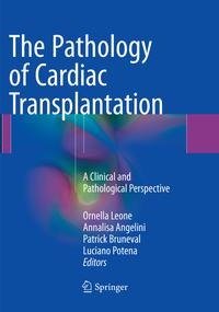 The Pathology of Cardiac Transplantation