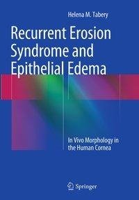 Recurrent Erosion Syndrome and Epithelial Edema