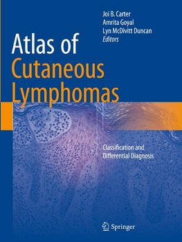 Atlas of Cutaneous Lymphomas