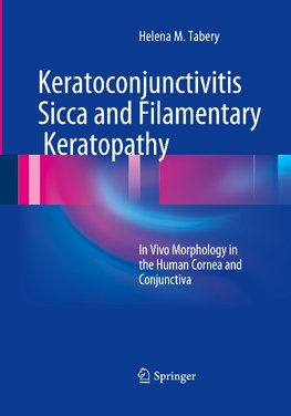 Keratoconjunctivitis Sicca and Filamentary Keratopathy