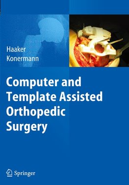 Computer and Template Assisted Orthopedic Surgery