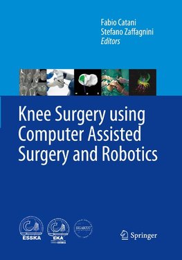 Knee Surgery using Computer Assisted Surgery and Robotics