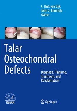 Talar Osteochondral Defects