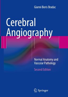 Cerebral Angiography