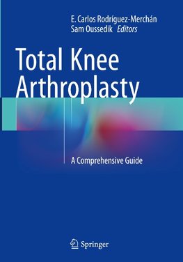 Total Knee Arthroplasty