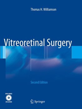 Vitreoretinal Surgery