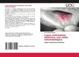 Lupus eritematoso sistémico, una visión estomatológica