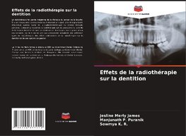 Effets de la radiothérapie sur la dentition