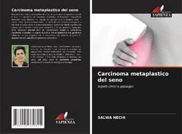 Carcinoma metaplastico del seno