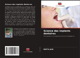 Science des implants dentaires