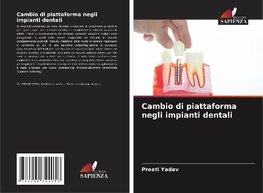 Cambio di piattaforma negli impianti dentali