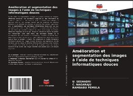 Amélioration et segmentation des images à l'aide de techniques informatiques douces