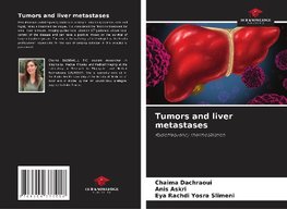 Tumors and liver metastases