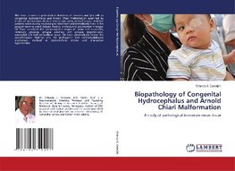 Biopathology of Congenital Hydrocephalus and Arnold Chiari Malformation