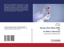 Plasma Rich FIbrin (PRF) & It's Role in Dentistry