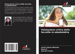 Valutazione critica delle faccette in odontoiatria