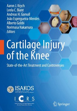 Cartilage Injury of the Knee