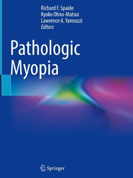 Pathologic Myopia