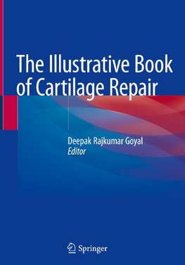 The Illustrative Book of Cartilage Repair