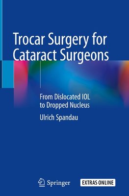 Trocar Surgery for Cataract Surgeons