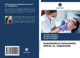 Endodontisch behandelte Zähne vs. Implantate