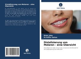 Distalisierung von Molaren - eine Übersicht