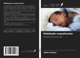 Moldeado nasoalveolar