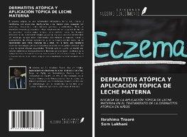 DERMATITIS ATÓPICA Y APLICACIÓN TÓPICA DE LECHE MATERNA