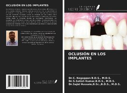 OCLUSIÓN EN LOS IMPLANTES